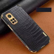Чехол бампер для Xiaomi Poco M4 Pro Anomaly X-Case Black (Черный) 