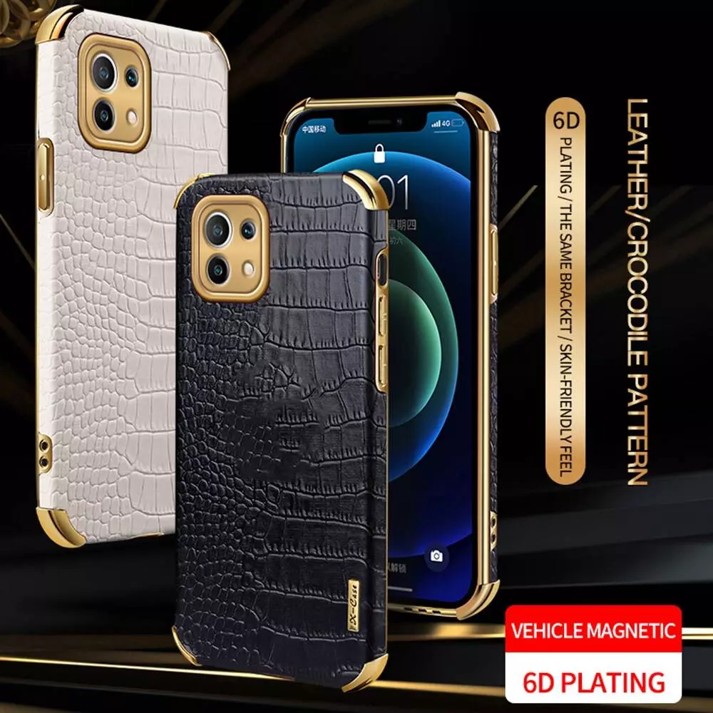 Чехол бампер для Xiaomi Mi 11 Lite / 11 Lite 5G NE Anomaly X-Case Yellow (Желтый)